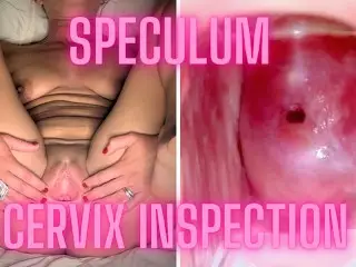 Hot Girl Lets us Explore her Cervix and Open her up with a Speculum