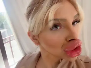 Biggest Fake Lips on the WORLD