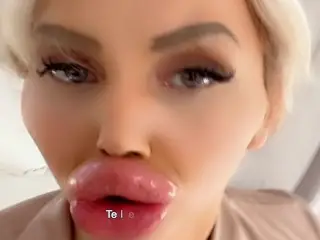 World Biggest Fake Lips + Close Ups | Vienna Wuerstel