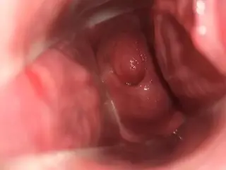 Showing my Open Cervix