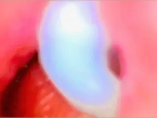 Endoscope Camera inside my Pink Pussy Records how he Fills me with Cum💎 - Couple Keyla & Lucas