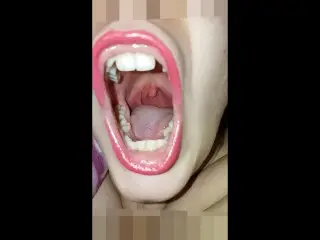 Girl Open Wide Mouth