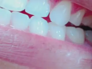 Teeth Fetish Examination