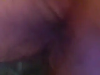 CLOSE UP Endoscope Asshole Hairy MILF Mature