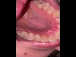 Mouth Tour. Uvula and Teeth