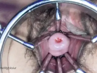 First Insertion: the Extremity Dildo. Spreader Pussy Held Wide Open. Cervix Showing. Speculum.