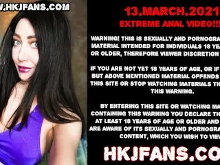 Hotkinkyjo Anal Balls Insertions with Fisting & Stuck Ball Prolapse HKJFANS