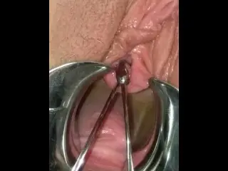 Extreme BDSM Female Urethral Stretching Medical Fetish Speculum Peehole Play