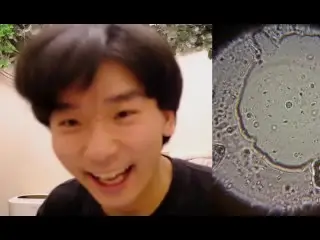 初めての精子観察