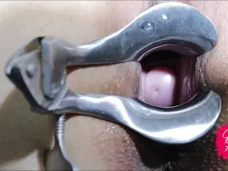 3 DIFFERENT SPECULUMS - GYNO FETISH