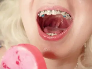 ASMR Mukbang in Braces - Eating Icecream