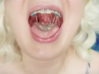 Braces Fetish: Close up Video Mukbang Tasty Ice-cream