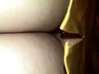 Young hirsute lady exposed in subway