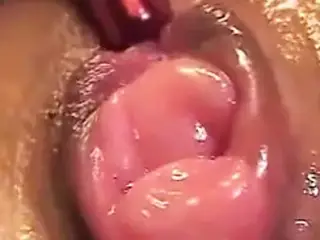 Prolapsed Asian Pussy Squirting