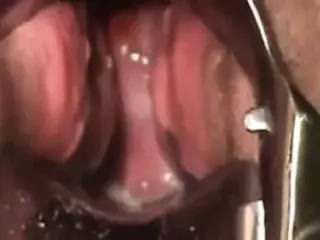 bbw masturbate with speculum show cervix contracting orgasm