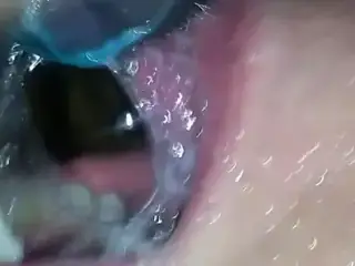 (MUST SEE) GIRL HAS NO LIMITS