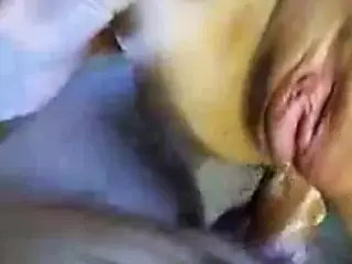 Argenta anal