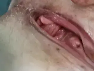 pussy prolapse