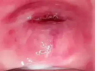 cervix