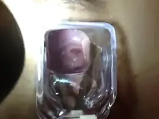 check out her cervix with speculum