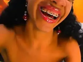 Uncle Jeb - Lovin' The Braces!