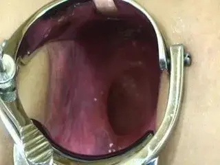 Elmer's Wife Extreme Speclum - Anal Gape!- kak1
