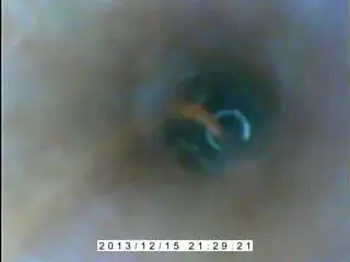 Inside my peehole