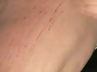 scratch marks