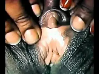 The Clitoris