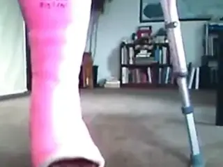 cast fetish - broken ankle