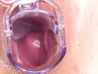 Gyneco hot