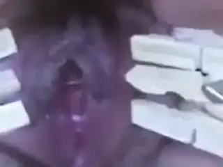 clothespins and plug