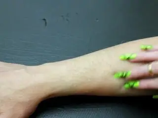 Nails scratching Arm