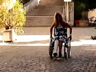 Milf, DBK Amputee, Cast Leg