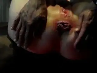 nice prolapsette by anal mature