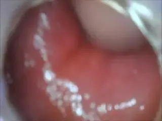 anal endoscope ass play from inside