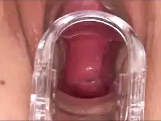 Gyno latino