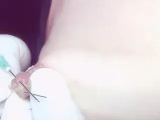 big nipple needle play2
