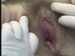 Gyno training for speculums