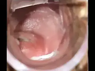 Speculum orgasm 1