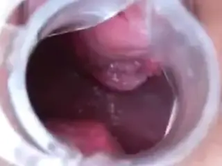 Wife has Speculum Orgasm Contractions 0:46