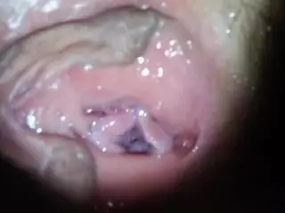 Buglarian sex