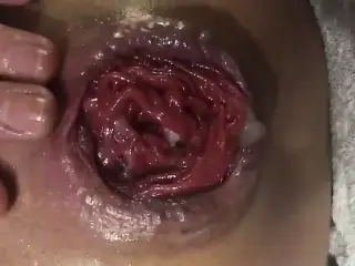 Moscow anal and vaginal fisting