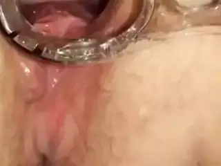 BBW opened up with speculum