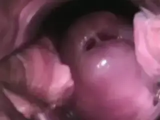 CERVIKAL ORGASM IN DETAIL