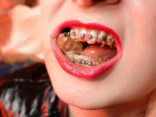 ASMR mukbang FOOD FETISH eating video close up with BRACES