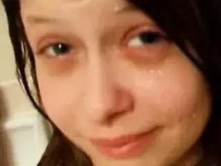 Pee on bruised tits