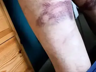 Caned by wife