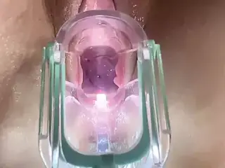 Stella St. Rose - Extreme Gaping, See my Cervix Close-Up using a Speculum