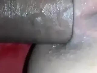 Anal sex